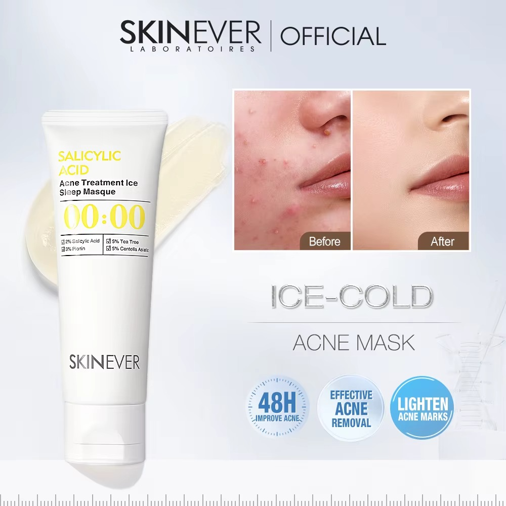 Skinever ClearFreeze Acne Mask