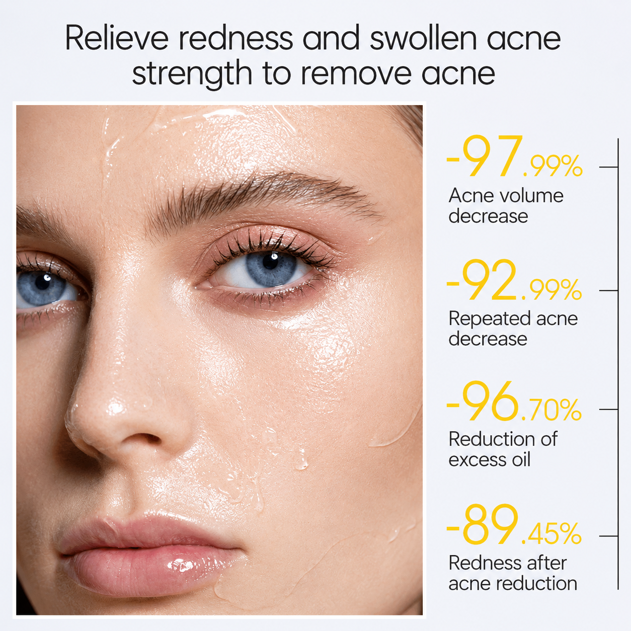 Skinever ClearFreeze Acne Mask